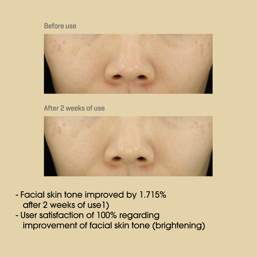 Yuja Niacin Anti Blemish Serum 50ml