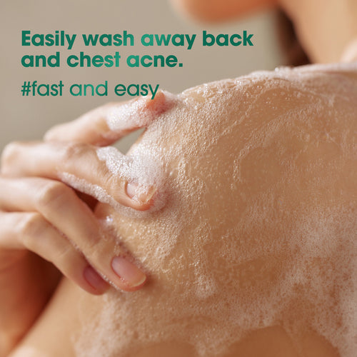 AHA-BHA-PHA 30 Days Miracle Acne Body Cleanser 400g