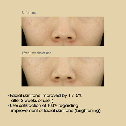 Yuja Niacin Anti Blemish Serum 50ml
