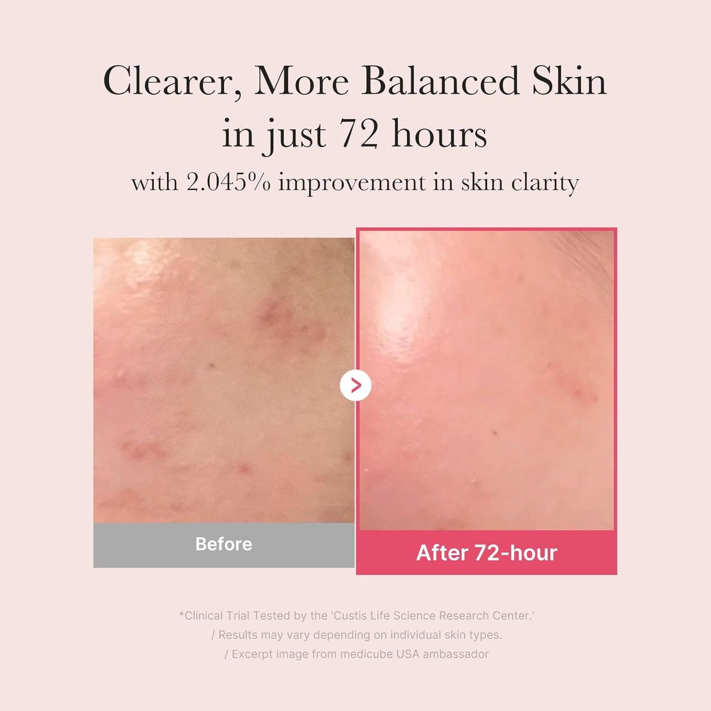 TXA Niacinamide 15% Serum 30ml